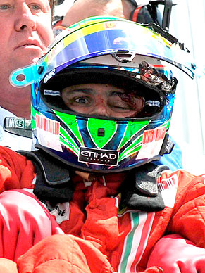 Foto exibida pelo globoesporte.com mostra o estrago feito por peça do carro do Barrichelo no capacete e rosto de Felipe Massa, que passa bem, mas não correrá amanhã